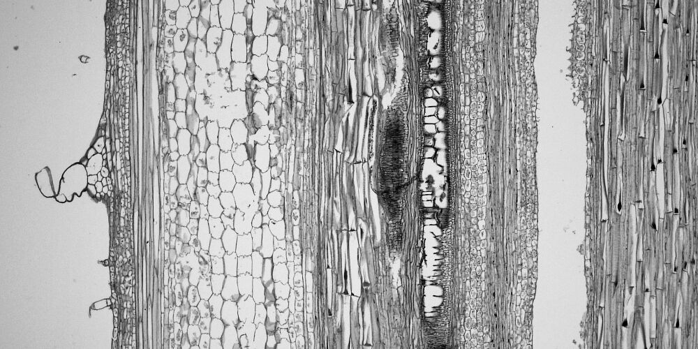 Сильно развиты механические ткани листа. Склеренхима мертвые клетки. Механическая ткань древесины. Раневая ткань растений. Волокна склеренхимы.